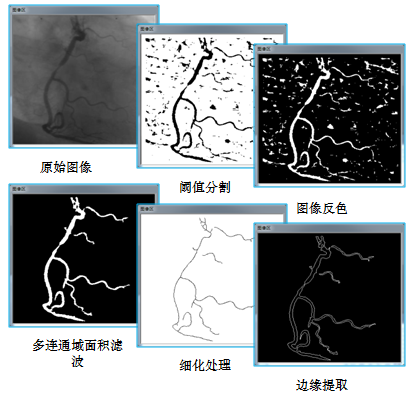機(jī)器視覺(jué)-應(yīng)用實(shí)例